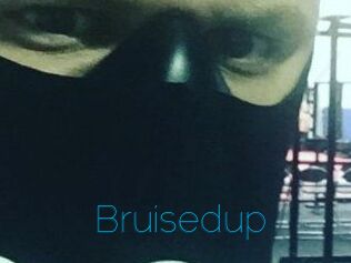 Bruisedup