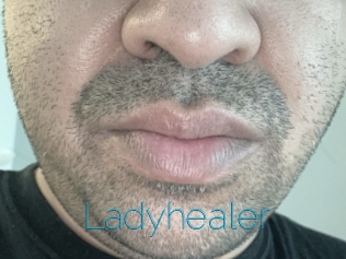 Ladyhealer